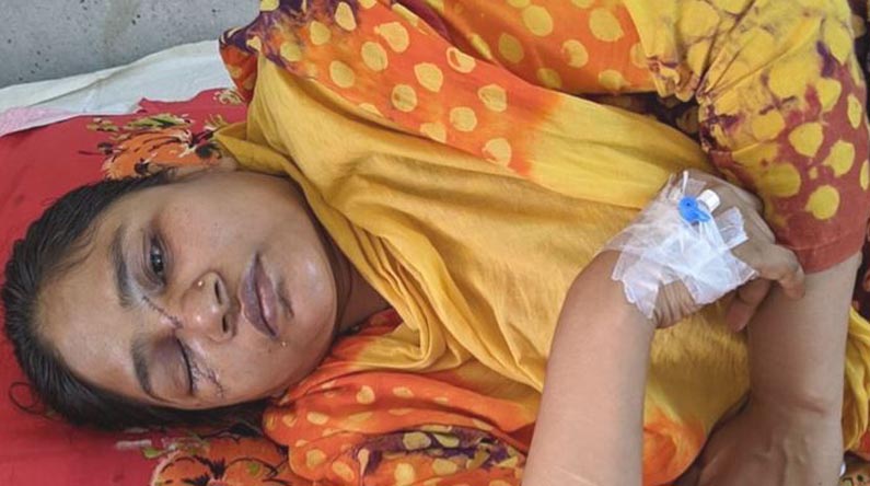 চোখ হারানো সেই শিক্ষিকার খোঁজ নিল না কেউ